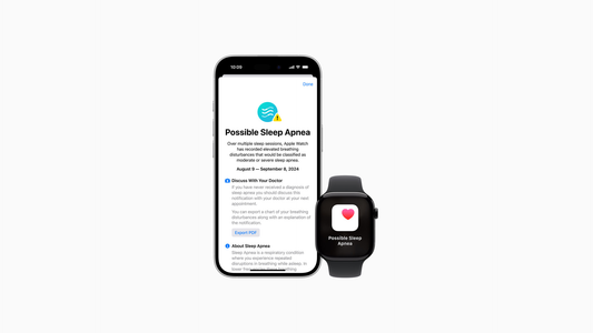 Alváskövetés az Apple Watch segítségével - iSTYLE HU