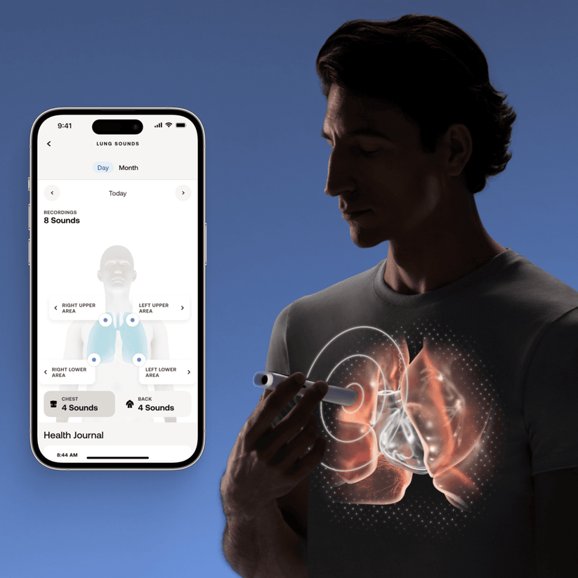 Withings – Beam-O MultiScan - fehér - iSTYLE HU