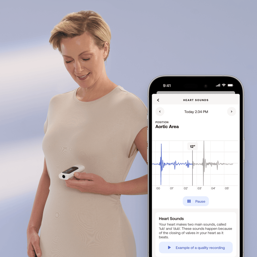 Withings – Beam-O MultiScan - fehér - iSTYLE HU